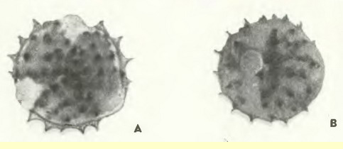 Золотая розга, золотарник (Solidago virda aurea L.)-пыльцевые зерна Золотая розга, золотарник (Solidago virda aurea L.)-пыльцевые зерна